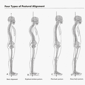 postural-assessment